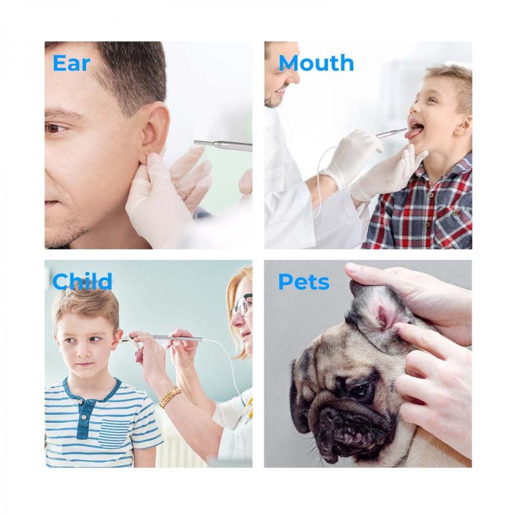 Rechargeable digital otoscope with 4.5-inch screen for family ear health. HD camera aids safe ear wax removal.