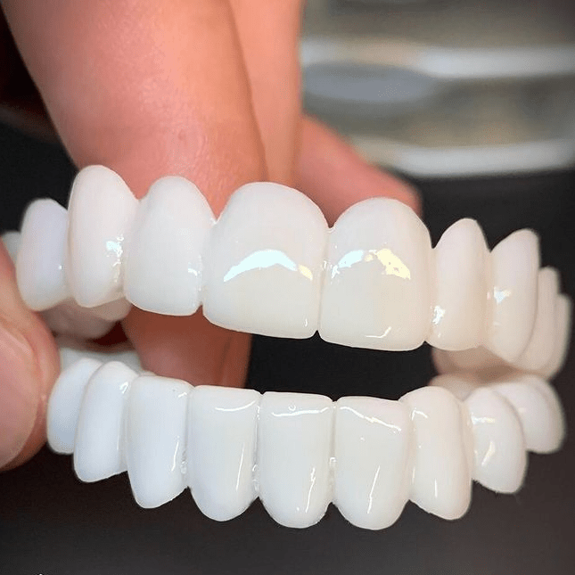 Unisex instant smile enhancer dental veneers with white lenses for brighter, cosmetic teeth.