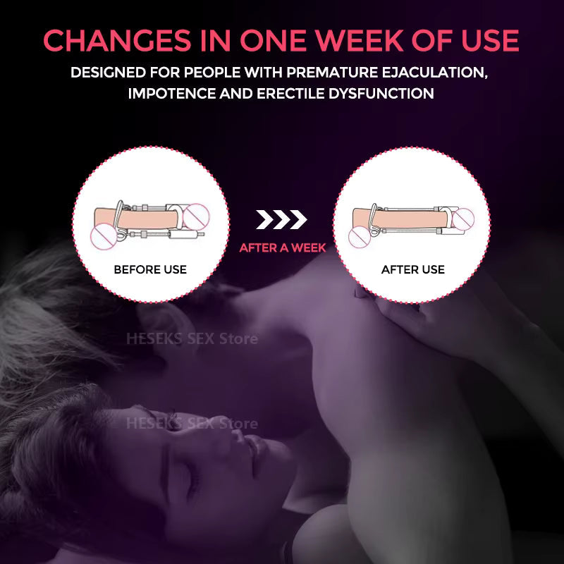 Complete male traction device for natural enhancement, growth & personal body confidence.