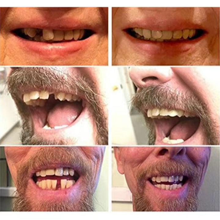 "Natural-look temporary false teeth, realistic design for seamless fit, suitable for men and women, enhances smile."