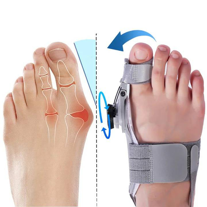 Unisex bunion corrector with toe spacer in beige silicone, featuring adjustable heel strap for foot pain relief and alignment