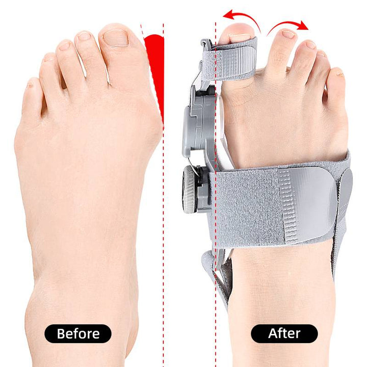 Unisex bunion corrector with toe spacer in beige silicone, featuring adjustable heel strap for foot pain relief and alignment