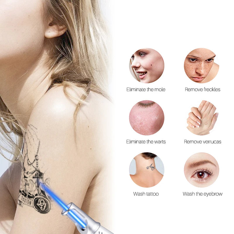 Easy-to-use portable laser pen for home treatment of tattoos, moles & blemishes.